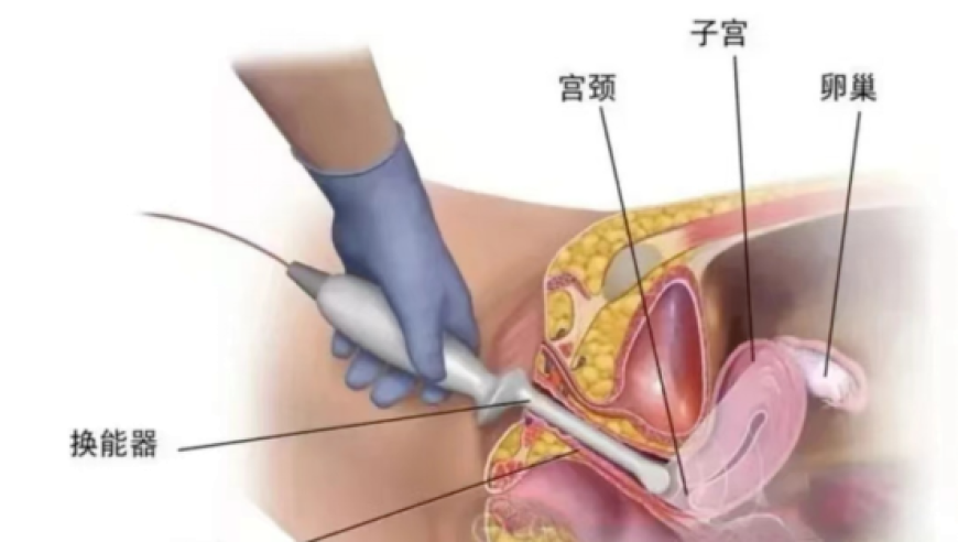特朗普将在未来几周发放金卡签证,香港曾道长个人资料彩图,多元化方案执行策略_优选版V14.44